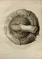  no thumbnail available